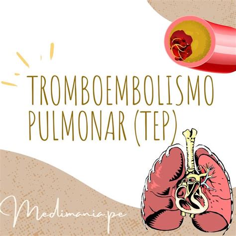 Tromboembolismo Pulmonar TEP Medimania Pe UDocz