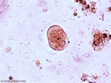 Trofozoítos De Entamoeba Histolytica E Dispar Fotografias Microscópicas E Macroscópicas