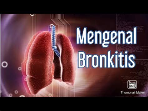 Mengenal Bronkitis Penyebab Bronkitis Dan Cara Pengobatan Bronkitis