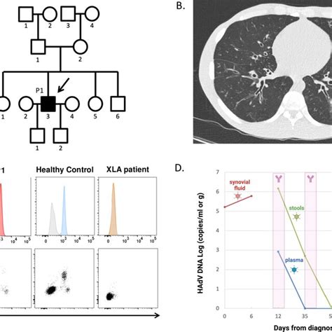 A Pedigree Of The Patient Depicted In Black Iii Or P With Human