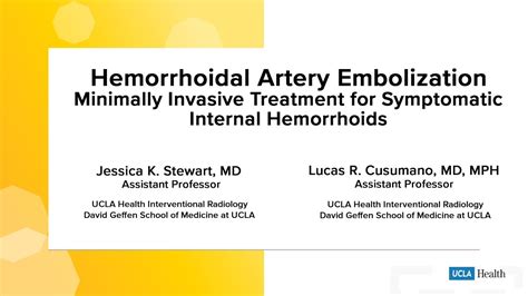 Hemorrhoidal Artery Embolization Minimally Invasive Treatment For