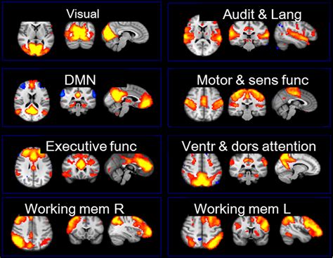 Resting State Functional Mr Imaging A New Window To The Brain Radiology