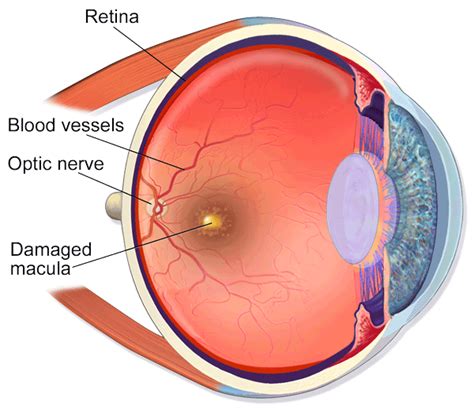 Effects Of Screen Time On Your Eyes Recreationtime Net