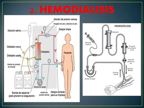 Aplicación De La Ósmosis En La Medicina M Y M F