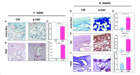 Histological And Histomorphometric Analysis Of New Bone Formation