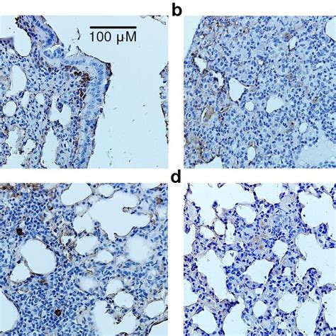 Sections Of Lung Tissue Cd68 Immunostaining Nuclei Stained With