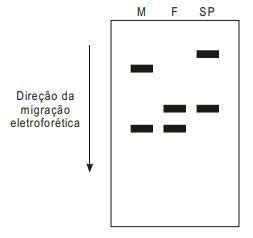 Testes De Dna Para Determina O De Paternidade S O Hoje Em Dia