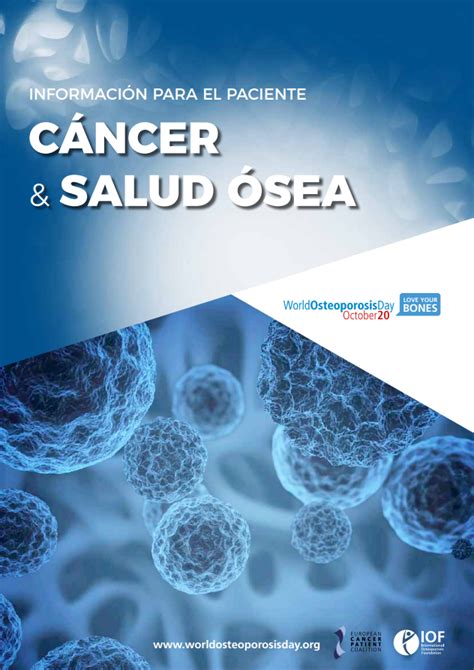 Prevención de osteoporosis en hombres Asociación Colombiana de