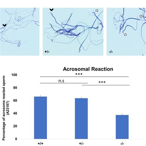 The Acrosomal Reaction Ar Using Calcium Ionophore A