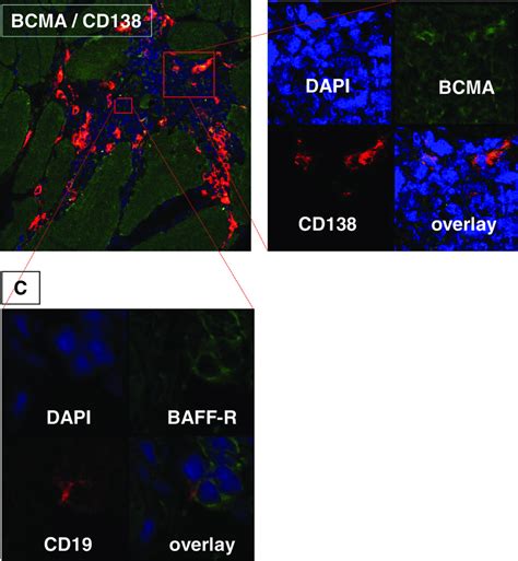 Immunofluorescent Double Staining Of B And Plasma Cells Expressing