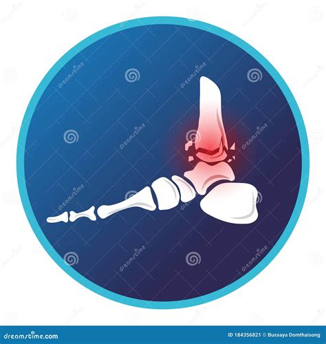 Icono Del Tobillo De Fractura Dise O Plano Vectorial Para El Hospital