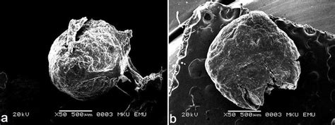 a. SEM image of a sialolith, b. SEM image of a sialolith that was ...