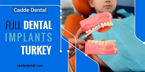 Signs Your Full Dental Implants Turkey Cadde Dental