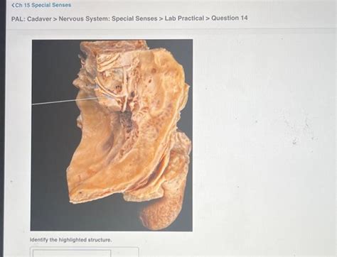 Solved Pal Cadaver Nervous System Special Senses Lab Chegg