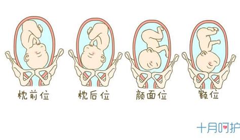 孕晚期極易出現的胎位問題，孕媽這樣做照樣能順產 每日頭條