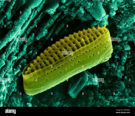 Coloured Scanning Electron Micrograph Sem Of Salt Water Pennate