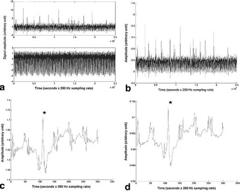 Results Of Two Postprocessing Methods For Removal Of Epi Artifacts From