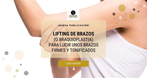 Cirug A De Lifting De Brazos Rejuvenece Y Tonifica