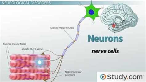 What are Neurological Disorders? - Definitions & Causes - Lesson ...