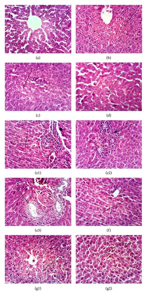 Photomicrograph Of Liver Sections Stained By Haematoxylin And Eosin Download Scientific Diagram