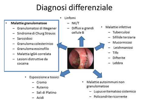 Malattie Rare Del Naso E Dei Seni Paranasali Prof Matteo Trimarchi