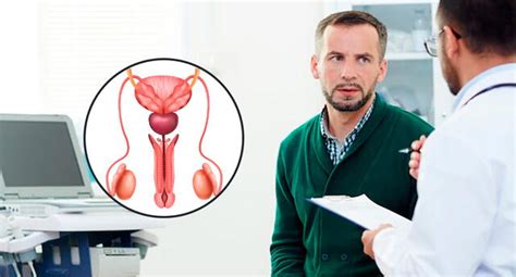 Cáncer De Próstata Cuáles Son Los Exámenes Que Todo Hombre Debe Realizarse Para Detectar A