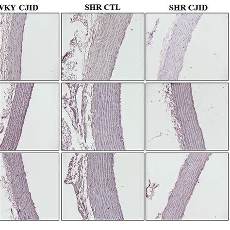 Cji Decoction Down Regulated Inos Expression P Ikba And Ikba