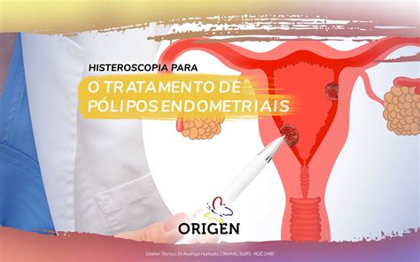 Histeroscopia para o tratamento de pólipos endometriais Clínica