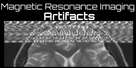 Magnetic Resonance Imaging Oncology Medical Physics