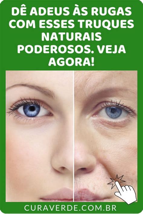 Elimine P S De Galinha E Rugas No Rosto Fazendo Isso Em Rugas