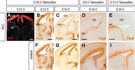 Figure S2 Timing Of Pax6 Deletion From Iko Embryos Related To Fig