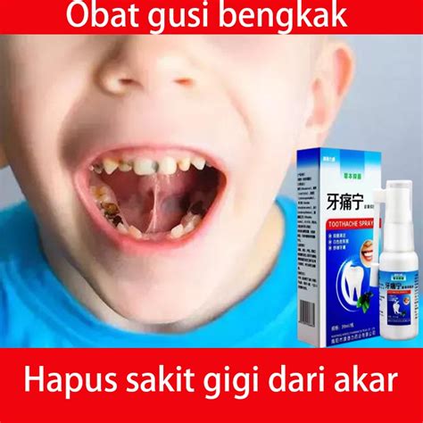 Jual Obat Sakit Gigi Semprot Semprotan Pereda Nyeri Obat Sakit Gigi