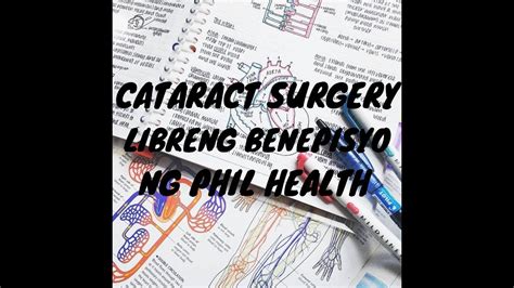 Cataract Surgery Para Sa Senior Citizen Libreng Benepisyo Ng