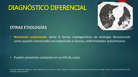 Lesiones Pulmonares Cavitadas Ppt