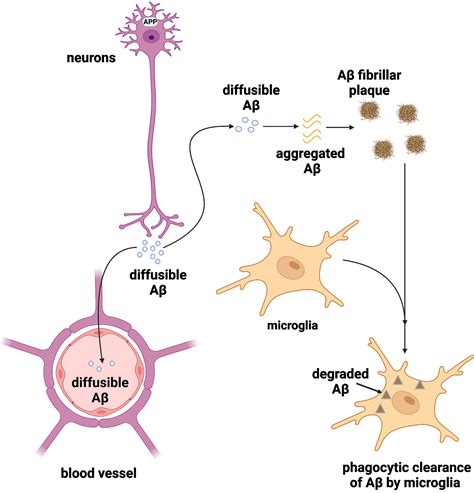 How Can We Use Mathematical Modeling of Amyloid β in Alzheimers