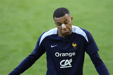 Euro Mbappe Kembali Latihan Lihat Hidungnya