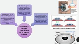 Cirugía refractaria y laser en oftalmología PPT