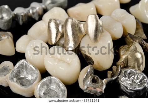 False Teeth Old Worn Stock Photos - 42 Images | Shutterstock