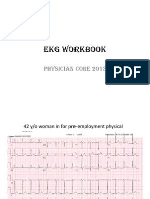 Ekg examples pdf electrocardiography cardiovascular system – Artofit