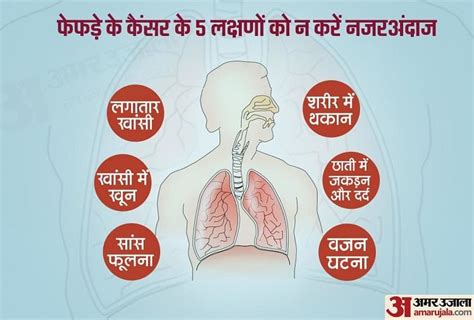 फेफड़े के कैंसर के इन लक्षणों को कतई न करें नजरअंदाज World Cancer Day