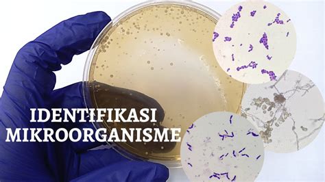 Identifikasi Mikroorganisme Screening Bakteri Streak Kuadran Bacteria Indentification Single