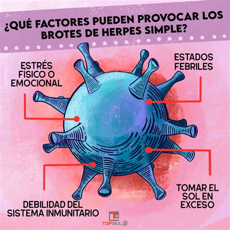 Herpes Simple Causas Y Tratamiento Infografia Top Aul