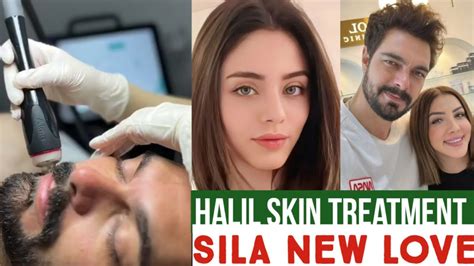 Halil Ibrahim Ceyhan Skin Treatment Sila Turkoglu New Love YouTube