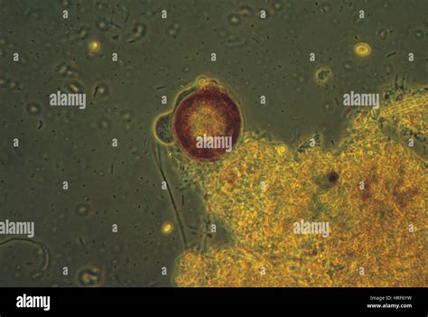 Shelled Amoeba Light Micrograph Hi Res Stock Photography And Images