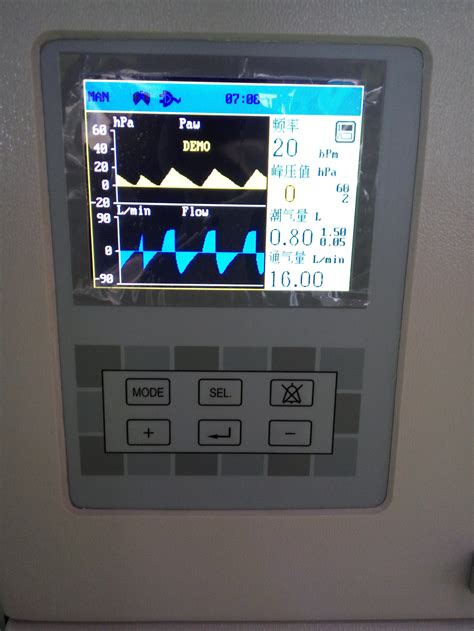 YSAV820 Quality Mobile Anesthesia Machine Ventilator With TFT Display