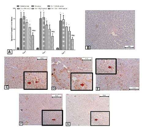 Immunohistopathological Examination For The Expression Of Caspase 3 In