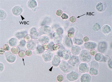 Microscopic Examination Of Urine Flashcards Quizlet