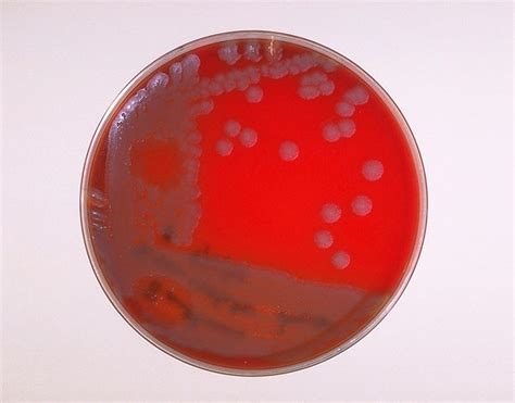 Public Domain Picture Blood Agar Plate Culture Of Bacillus Anthracis