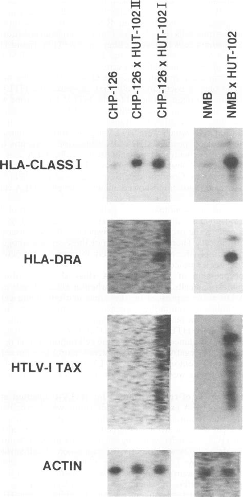 Detection Of HTLV I And HLA RNA Transcripts On Cocultured Neuroblastoma