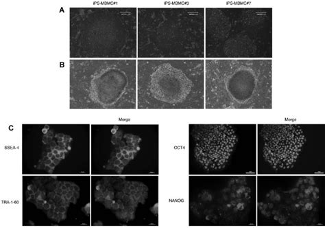 Phenotypic Characterization Of Ips Mbmc Clones A Phase Contrast